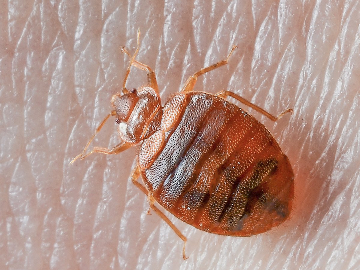 What to Do for Bed Bug Bites – Best Remedies in 2024